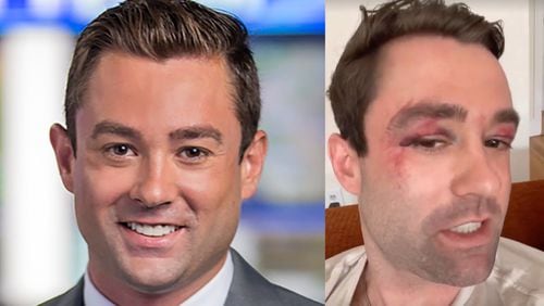 Adam Klotz, a Fox News meteorologist who previously worked at Atlanta's Fox 5, was attacked by a group of teens in a New York City subway over the weekend. FOX 5/INSTAGRAM