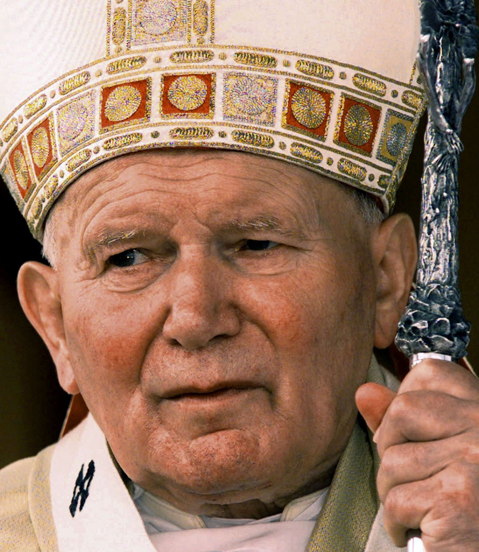 Photos: 10 famous people with Parkinson's disease