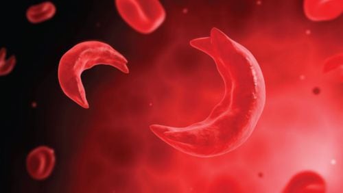 Understanding and effectively treating the group of blood disorders that is sickle cell disease should be a community priority.