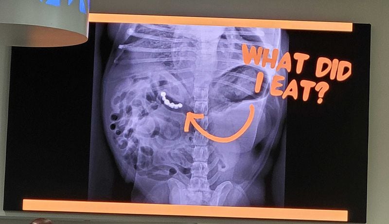 During their first hour of Vet for a Day, participants played a game of What Did I Eat? Drs. Terrence Ferguson and Vernard Hodges brought X-rays, and the kids had to try to guess what the pet consumed. In this case, it was false teeth.