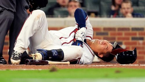 Kurt Suzuki reacts after being hit in the hand by a pitch in the second game of the season. (Photo by Daniel Shirey/Getty Images)