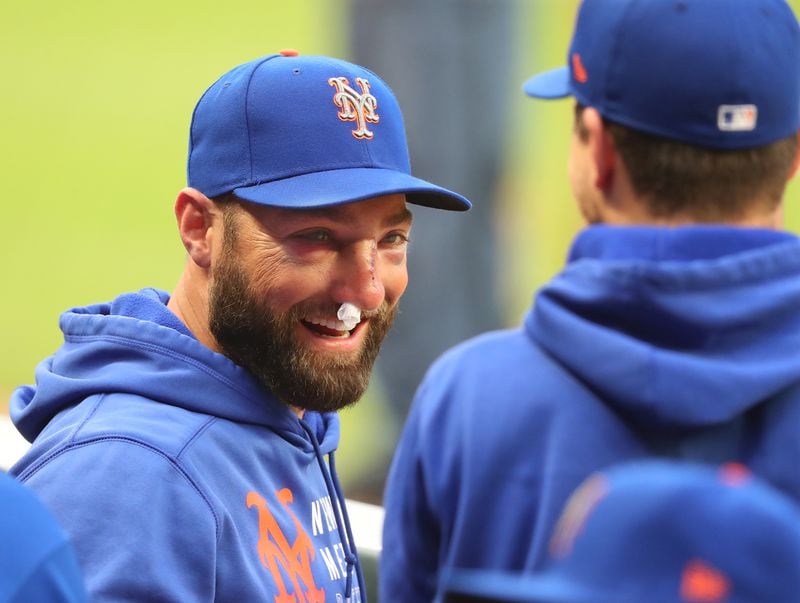 Despite being hit by a pitch in the face and suffering a fractured nose in the previous day's game, the New York Mets' Kevin Pillar is smiling in the dugout on Tuesday, “Curtis Compton / Curtis.Compton@ajc.com”