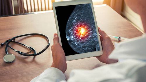 Google AI Detects Breast Cancer More Accurately Than Doctors