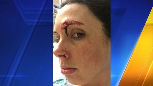 Police say Kelly Herron was attacked by a homeless sex offender inside a public bathroom at a popular park in Seattle. (KIRO/Cox Media Group)