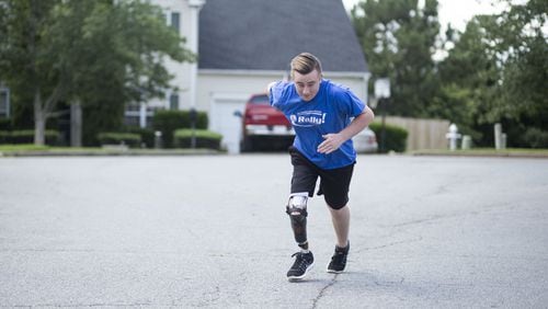 Matthew McMahon begins a jog, practicing for his triathlon in August, in his neighborhood in Woodstock recently. In 2014, McMahon was diagnosed with bone cancer. This not only required intensive treatment, but also the amputation of his right leg from the knee down. McMahon, who is in remission, wears a prosthesis. On June 25, McMahon, who competed in his first post-diagnosis triathlon last August, will serve as emcee for the seventh annual PT Solutions Allatoona Triathlon. Proceeds will benefit the Rally Foundation for Childhood Cancer Research. CHAD RHYM / CHAD.RHYM@AJC.COM
