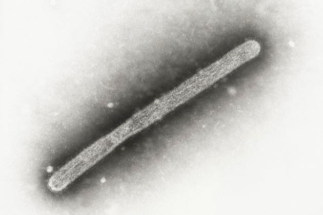 This 2005 electron microscope image shows an avian influenza A H5N1 virion. On Wednesday, May 22, 2024, Michigan health officials said a farmworker has been diagnosed with bird flu, the second human case connected to an outbreak in U.S. dairy cows. (Cynthia Goldsmith, Jackie Katz/CDC via AP)