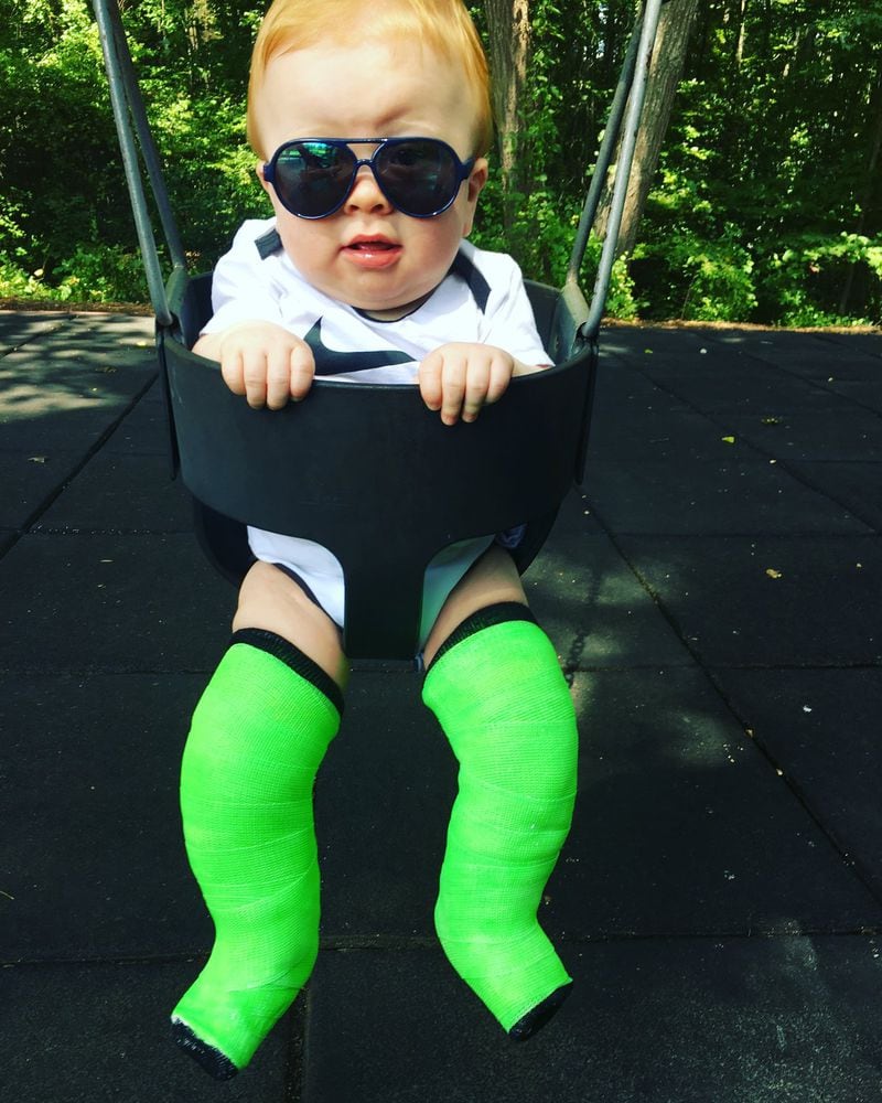Photo of Easton in a swing with his bright green casts in attempt to fix a foot deformity he was born with. He’s about 8 month old in this photo. CONTRIBUTED