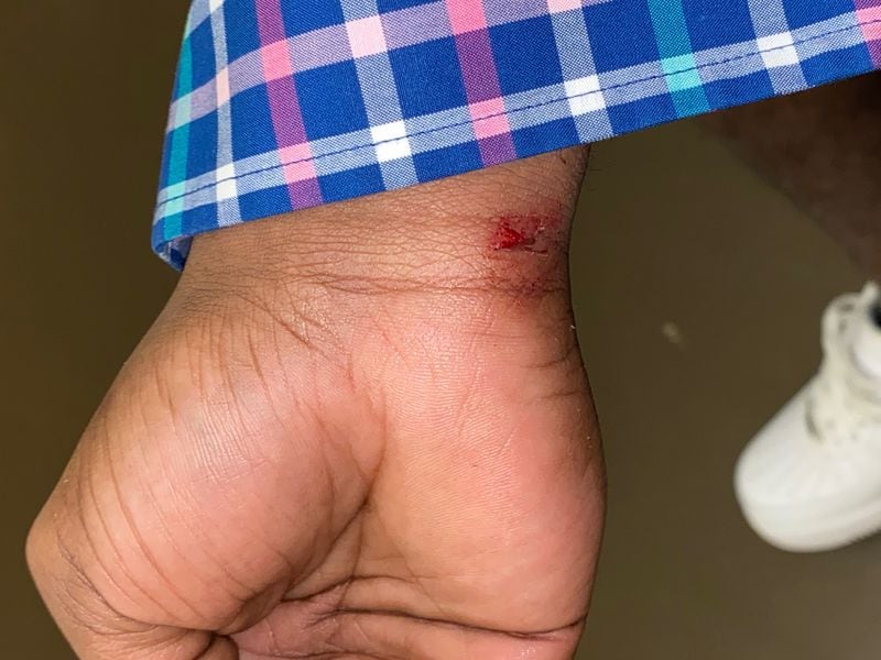 Rodalius Ryan was injured on his wrist during an alleged altercation with a Fulton County deputy during transport to the Fulton County courthouse.