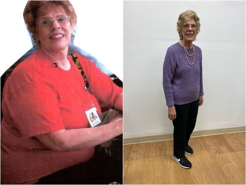 Ann Hedden, 79, before and after her weight loss. She said the biggest news she wanted to share is she kept her weight off after she lost it.