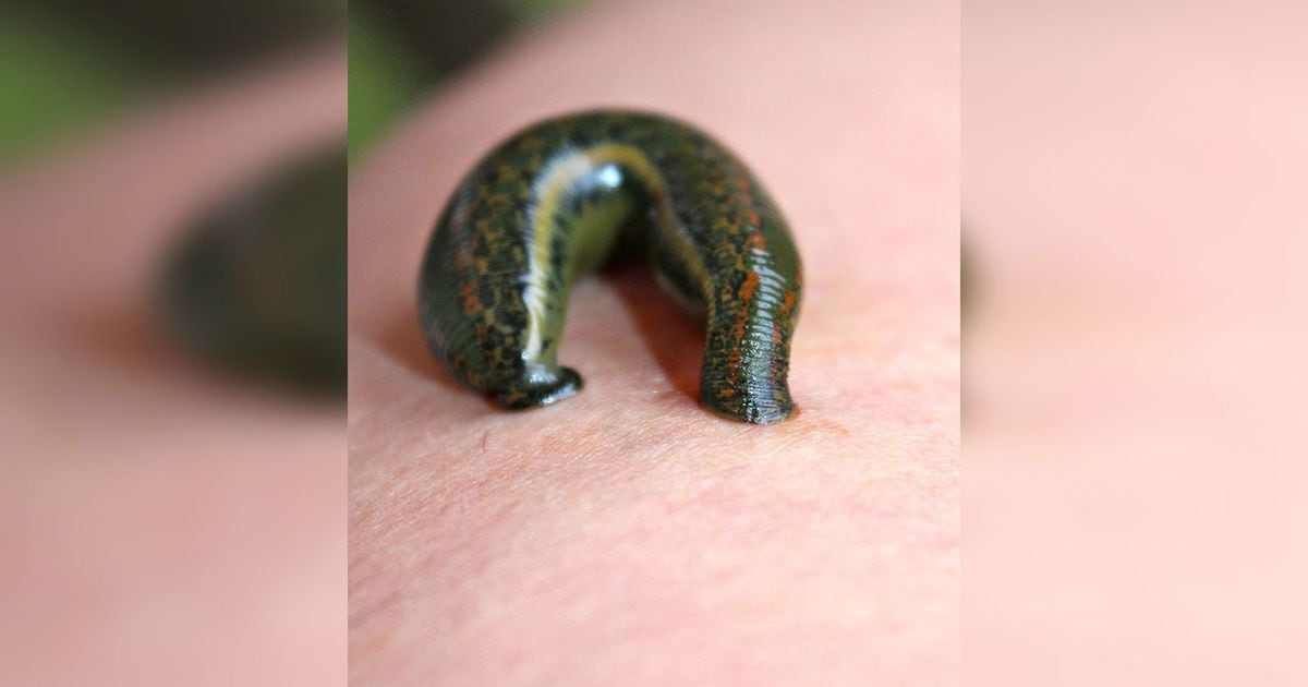 New species of leech has 3 jaws, almost 60 teeth in each found in