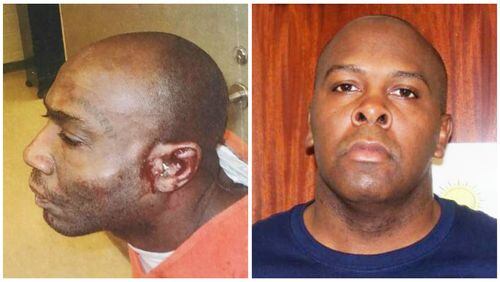 Joseph Sims, left, was battered by now-former DeKalb jailer Anthony Dozier, according to an indictment.