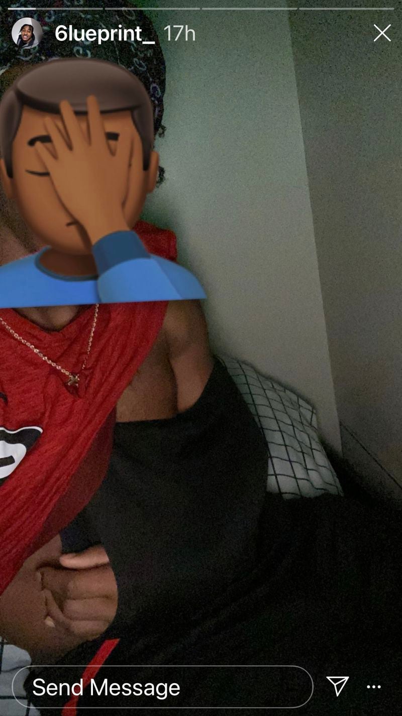 Georgia junior running back Kenny McIntosh posted this selfie on Instagram Sunday morning after spraining his right elbow in the Bulldogs' practice on Saturday. (Instagram)