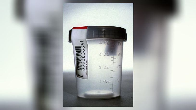 Federal prosecutors are accusing 10 people of using rural hospitals they controlled to submit fraudulent claims for urine and blood tests. (AP Photo/The Dallas Morning News, Natalie Caudill)