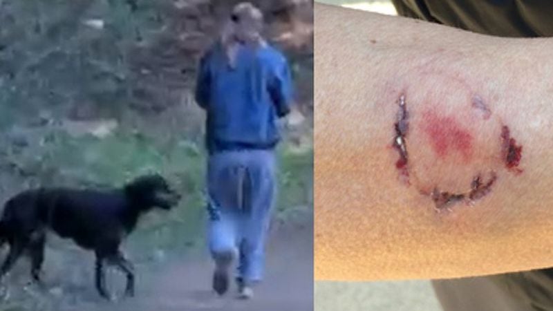 A dog owner was arrested after she allegedly bit a jogger who pepper sprayed her dog after it tried to attack her, according to police.