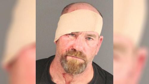 According to police reports, Edward Burns stabbed a Millis, Massachusetts, man in the back with a 10-inch kitchen knife during an argument July 18.