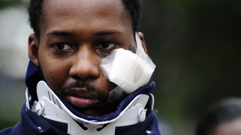 Tramaine Miller, who was shot in the face by off-duty Atlanta police Officer Reginald Fisher, leaves Grady Memorial Hospital in May 2009. The bullet remains lodged in Miller’s neck today. ELISSA EUBANKS/eeubanks@ajc.com