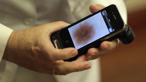 A doctor examining a patient for symptoms of skin cancer. (Photo by Joe Raedle/Getty Images)