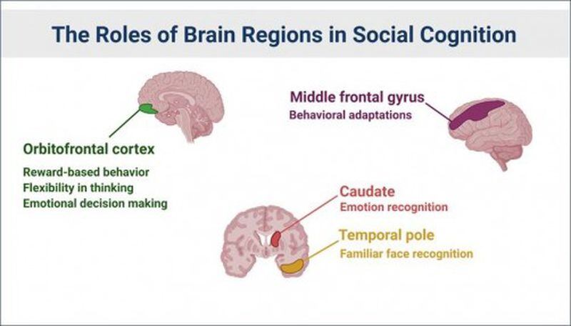 Roles of Brain Regions in Social Cognition Stimulus (input) of any kind such as smell or vision goes to the brain for further processing, so that a human being can identify a particular smell or picture. Based on the accurate recognition of a cue, responses are made by our bodies. The type of stimuli that occur in settings of social interaction are called social stimuli. They are processed by specific brain regions known as the ‘social brain.’ The brain gray matter regions we found have known roles in dementia. Since greater social engagement is associated with greater microstructural integrity of these regions, their brain cellular health is maintained, and therefore dementia can be prevented or delayed.
Sheila Davis/UPMC