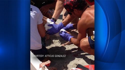 A young boy was severly injured when he was bitten by a shark at Cocoa Beach.