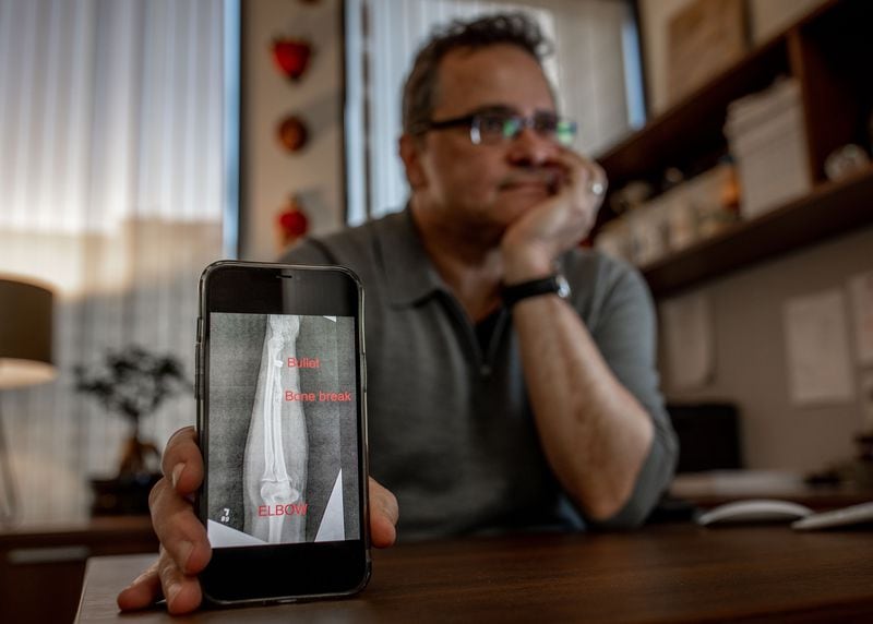 Georgia State University Professor Dr. Volkan Topalli shows his x-rays during an interview, Wednesday, Dec. 22, 2021, in Atlanta.  Volkan was shot in the arm when gunfire erupted while shopping at a Home Depot. (BRANDEN CAMP FOR THE ATLANTA JOURNAL-CONSTITUTION)