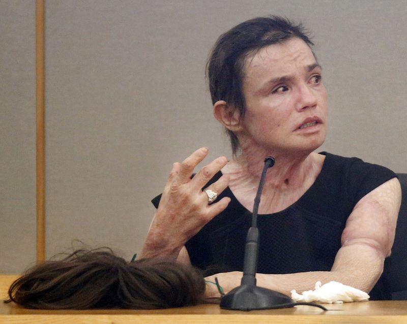Removing her wig, burn victim Danyeil Townzen showed her scars to the judge and former boyfriend during her emotional testimony about how former boyfriend Matthew Gerth set her on fire.