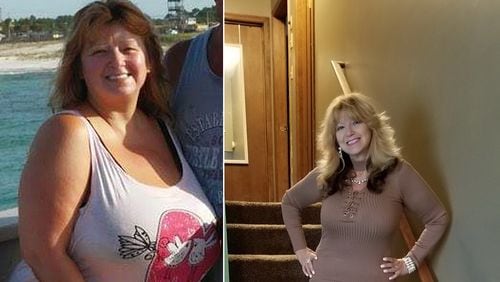 In the photo on the left, taken in 2015, Ramona Wood weighed 244 pounds. In the photo on the right, taken this past summer, she weighed 154 pounds. (All photos contributed by Ramona Wood)