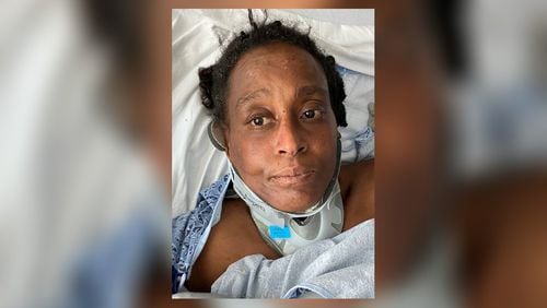 A woman who was struck by a car last month in Midtown was identified Thursday after Grady Memorial Hospital circulated the patient's photo and asked the public for help.