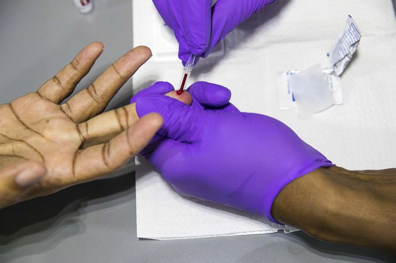 A CDC report from 2019 said infections in Georgia among Black men are 5.9 times higher than white men and 11.4 times higher for Black women compared to white women. (AJC file photo)