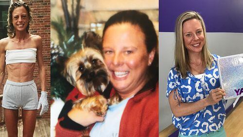 In the photo on the left, taken in 1999 when she was age 19, Kim Schaper weighed 75 pounds. In the center photo, taken two years, Schaper weighed 185 pounds. In the photo on the right, taken in November, Schaper weighed 135 pounds. She calls it her “healthy weight.”