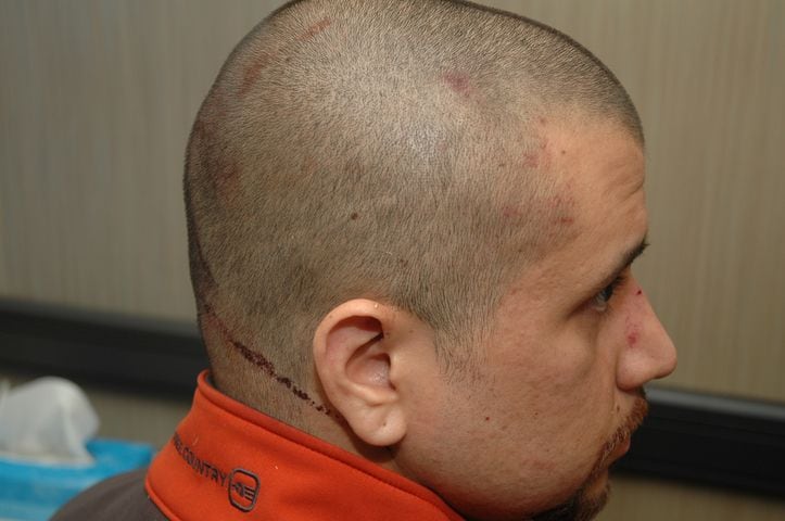 Evidence photos show bloodied Zimmerman, gun, more