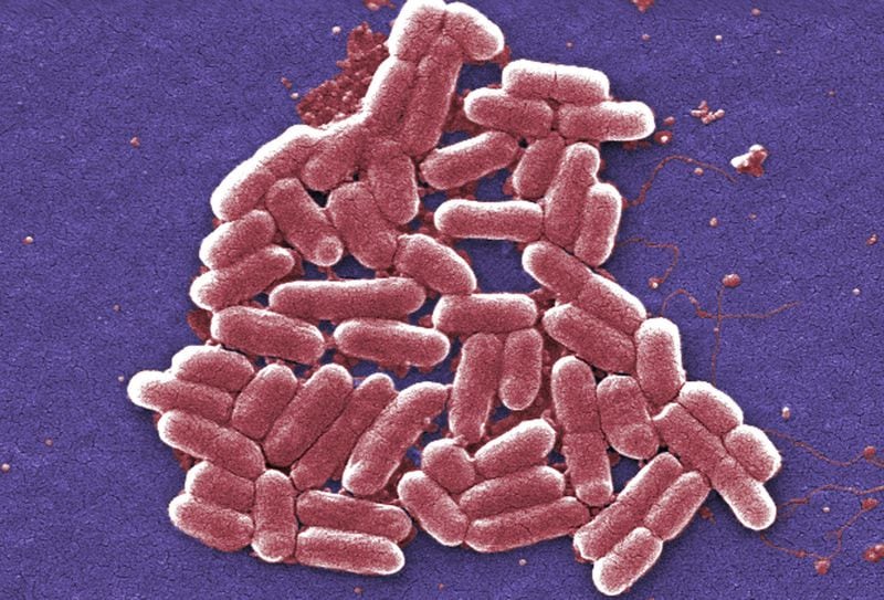 This 2006 colorized scanning electron micrograph image made available by the Centers for Disease Control and Prevention shows a strain of the Escherichia coli bacteria. (Janice Carr/CDC via AP)