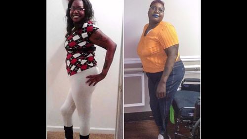 Nikosha Robertson before and after losing her leg.