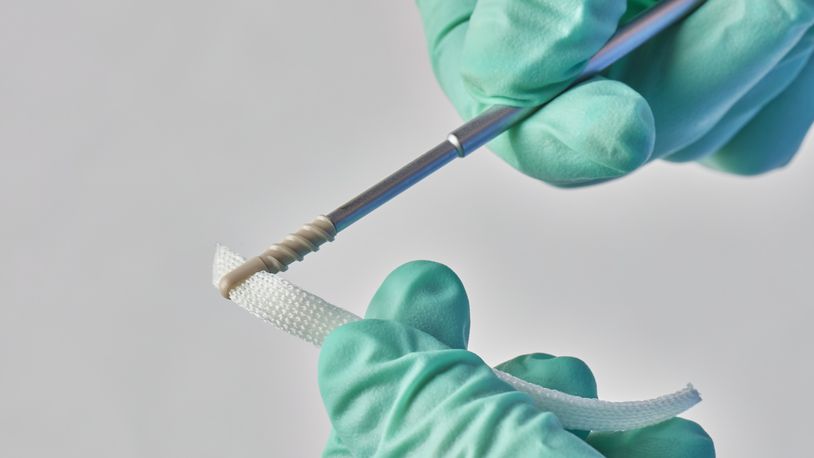 Marietta-based medical device company Artelon has developed FLEXBAND products, which are made from a combination of two polymers SPECIAL TO THE AJC from Artelon