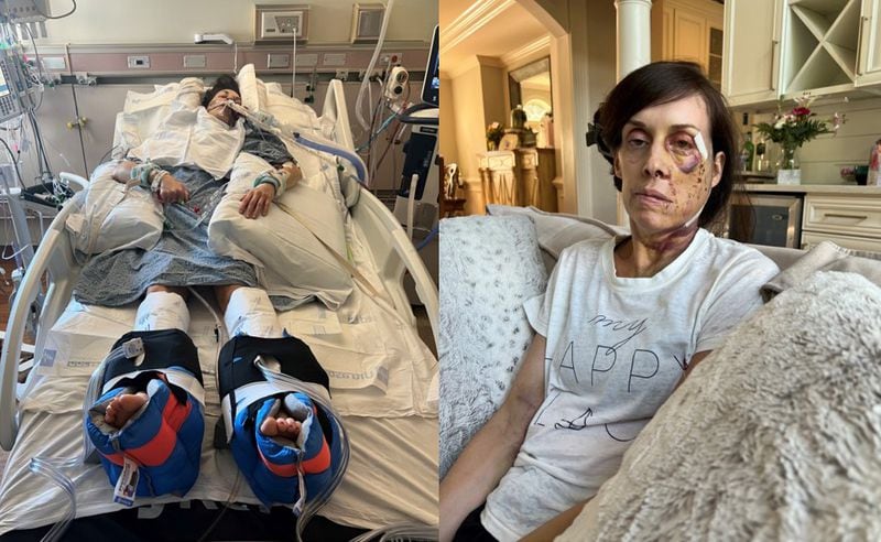 Alesha Hollinger is shown while in ICU at Grady Memorial Hospital (left) and at her home on Mother's Day 2023. COURTESY PHOTOS