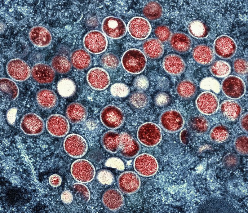 FILE - This image provided by the National Institute of Allergy and Infectious Diseases (NIAID) shows a colorized transmission electron micrograph of monkeypox particles (red) found within an infected cell (blue), cultured in the laboratory that was captured and color-enhanced at the NIAID Integrated Research Facility (IRF) in Fort Detrick, Md. Scientists say a new form of mpox detected in a mining town in Congo might more easily spread among people. Already, Congo is seeing its biggest mpox outbreak with more than 19,000 suspected infections and 900 deaths. (NIAID via AP, File)