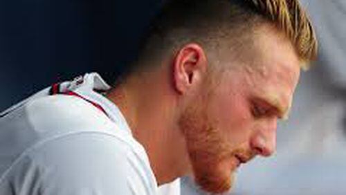 It's been a very rough season for Shelby Miller, the most luckless pitcher in the major leagues. (Getty Images photo)