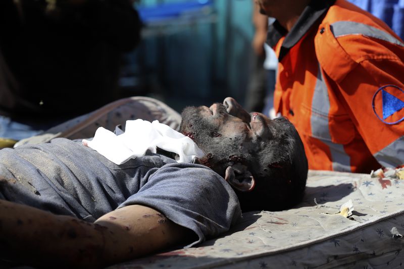 A Palestinian man who was seriously wounded in the Israeli bombardment of the Gaza Strip is brought to the Kuwaiti Hospital in Rafah refugee camp, southern Gaza, Tuesday, May 7, 2024. (AP Photo/Ramez Habboub