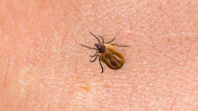 Tick crawling on human body skin (Dreastime/TNS)