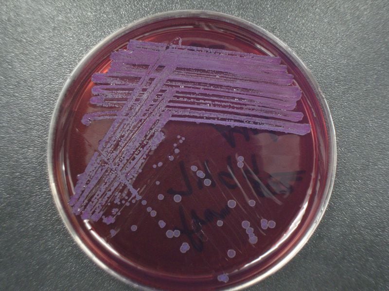 CDC microbiologist Mindy Glass Elrod with the agency's Bacterial Special pathogens Branch took this photo of the bacteria that causes melioidosis. The bacteria was isolated from a sample obtained in the household of a Georgia child who died of the disease. (CDC)