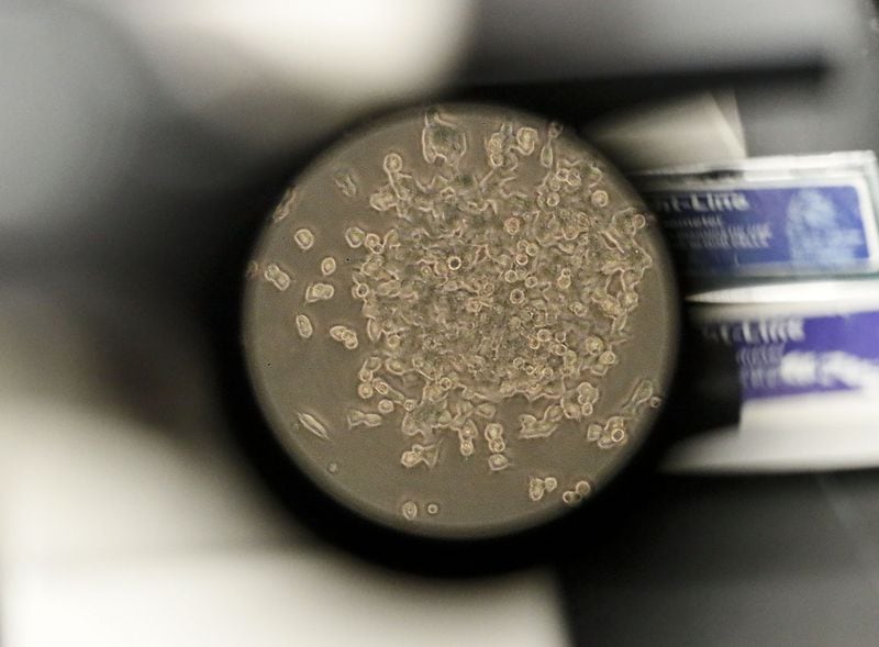 The view through a microscope at Smyrna-based GeoVax of one of the vaccine candidates for COVID-19 that the lab is working on. Bob Andres / robert.andres@ajc.com