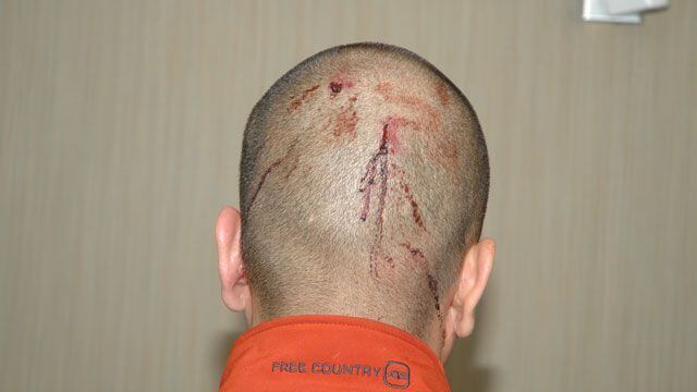 Evidence photos show bloodied Zimmerman, gun, more
