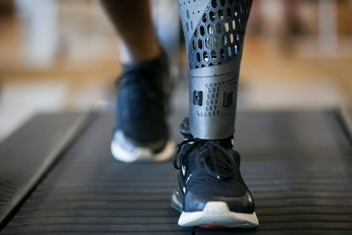 Tiran Jackson walks on a treadmill at Life Time Woodstock on Wednesday, July 6, 2022, in Woodstock, Georgia. Tiran Jackson said fitness is important to him to ensure he can continue to walk and maintain his balance with his leg and prosthetic. (Chris Day/Christopher.Day@ajc.com)