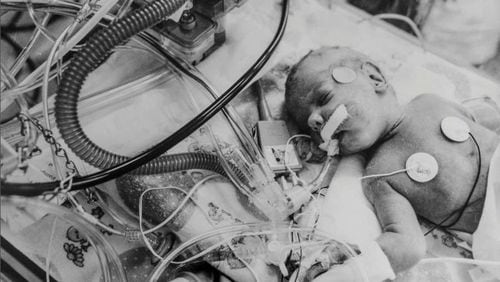 A 1-month-old boy, addicted to cocaine at birth, breathes with the help of a ventilator in an incubator at Grady Memorial Hospital. He was born eight to 10 weeks premature. (Walter Stricklin/AJC file)