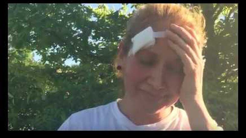 This woman was shot by a pellet gun after leaving Bible study in Sandy Springs.