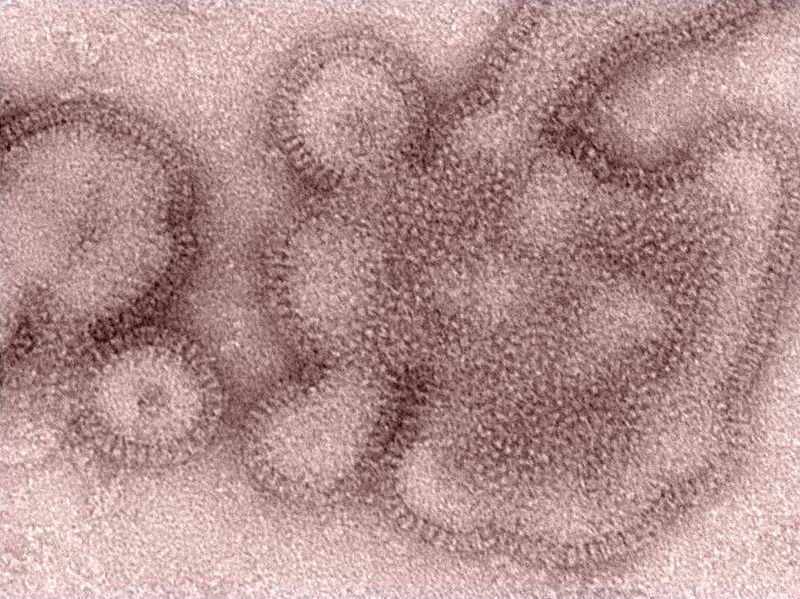 This 2011 Centers for Disease Control and Prevention photo shows the H3N2 strain of the flu. Centers for Disease Control and Prevention