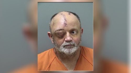 One of the bullets Ronald Goss fired at his estranged wife ricocheted and struck him in the face during a February 2018 ambush. Goss pleaded guilty to trying to kill his then-wife and was recently sentenced to 65 years in prison.