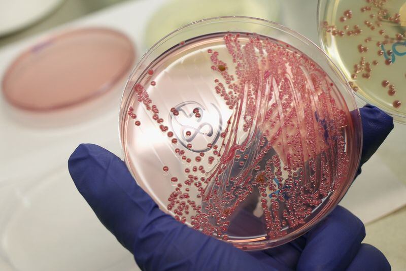 A lab technician holds a bacteria culture that shows a positive infection of enterohemorrhagic E. coli from a patient at the University Medical Center Hamburg-Eppendorf in Germany.