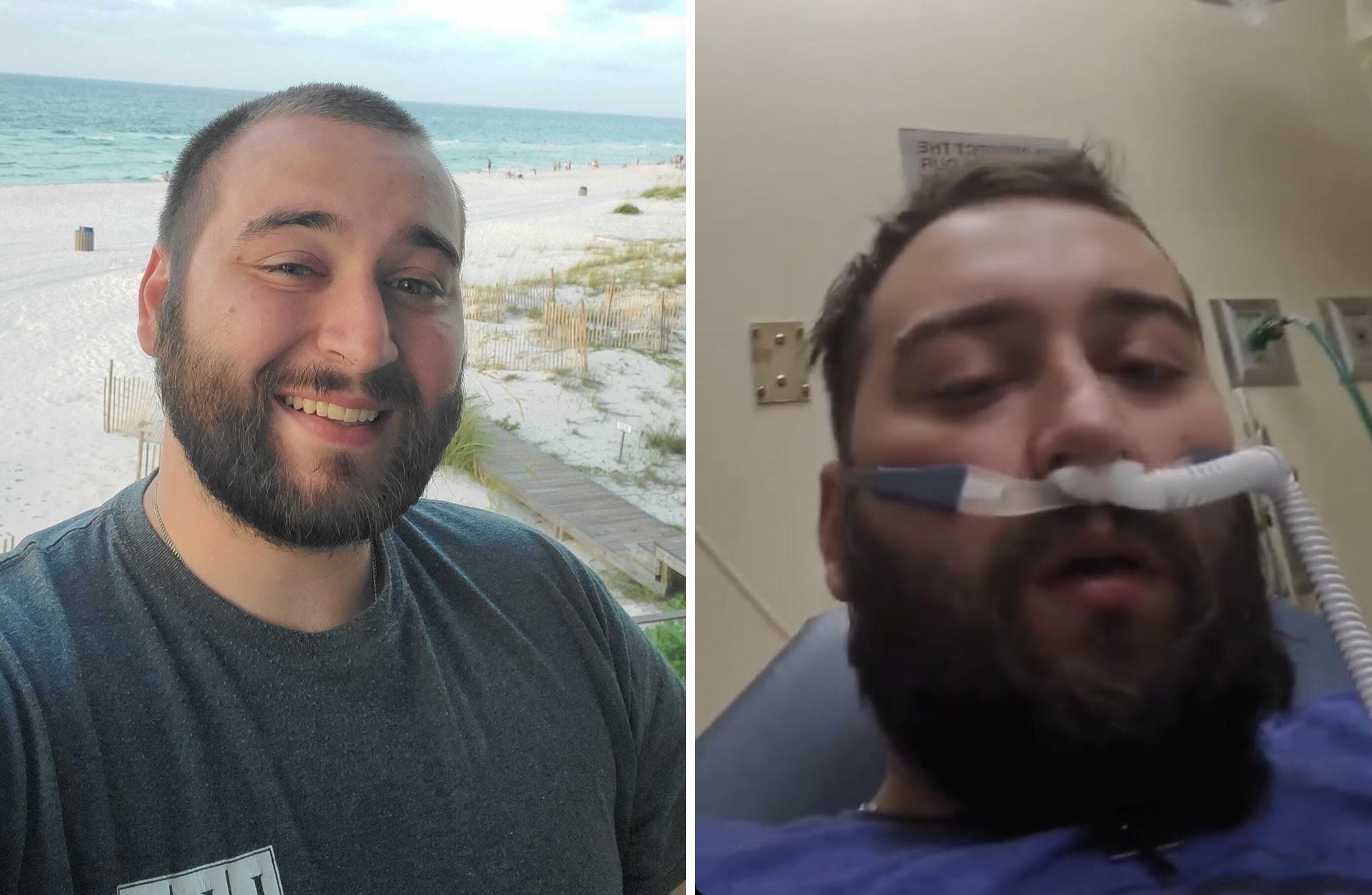 Bargatze moved to Florida a couple years ago and loved his job and living near the beach. He got sick in late March and, on the advice of his mother, went to the emergency room in April. He ended up fighting for his life in ICU for more than three months.