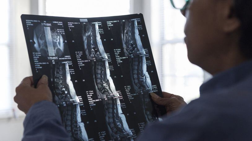 Sendy Wilburn, a former teacher in DeKalb County, holds up x-ray photos of her spine before one of her surgeries that took place in 2007 in Lithonia, on January 27, 2017. Wilburn has been pursuing a workers compensation claim against the DeKalb County School District since 2002. Numerous surgeries over 15 years have left her unable to work and her claim has yet to be resolved. (DAVID BARNES / DAVID.BARNES@AJC.COM)