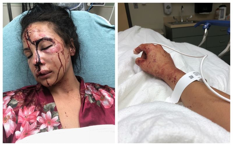 These photos of the victim, Delicia Cordon, were sent to the AJC from the Law Office of Tanya Mitchell Graham, her attorney.